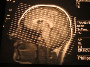x-ray-of-the-head-for-blog-june-8-2014.jpg